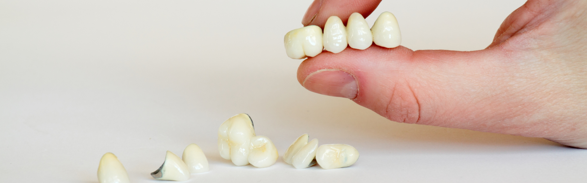 5 Important Facts To Know About Dental Crowns
