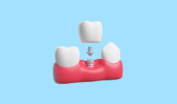 Benefits of Choosing Dental Implants at The Dental Co. of Leesburg