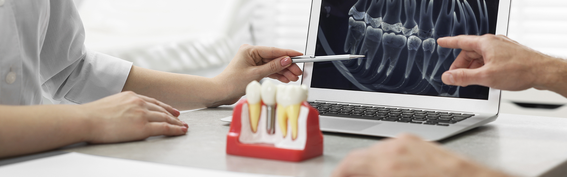 Maintaining Your Dental Implants: Tips for Long-Lasting Results