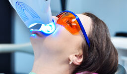 Teeth Whitening Options: What You Need to Know Before Visiting The Dental Co. of Leesburg