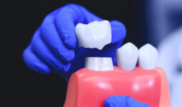 Is Getting a Dental Crown Painful? What You Can Expect in Leesburg, VA