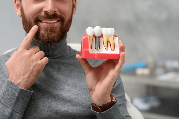 How Do Dental Implants Work at a Dentist in Leesburg, VA?